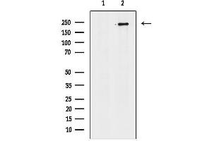 anti-Structural Maintenance of Chromosomes Flexible Hinge Domain Containing 1 (SMCHD1) (C-Term) antibody