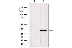 Western blot analysis of extracts from Mouse Myeloma cell, using PYCR1 antibody. (PYCR1 Antikörper  (Internal Region))