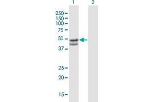 Western Blotting (WB) image for anti-serpin Peptidase Inhibitor, Clade B (Ovalbumin), Member 7 (SERPINB7) (AA 1-380) antibody (ABIN2565884)