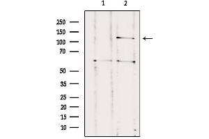 Western blot analysis of extracts from HUVEC, using CNTNAP3 Antibody. (CNTNAP3 Antikörper  (Internal Region))