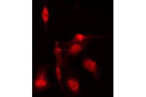ABIN6276872 staining HeLa cells by IF/ICC. (BUB1B Antikörper  (C-Term))