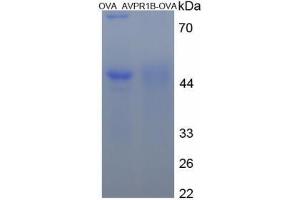 Image no. 1 for Arginine Vasopressin Receptor 1B (AVPR1B) peptide (Ovalbumin) (ABIN5666088)