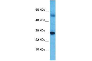Host:  Rabbit  Target Name:  NKX6-3  Sample Type:  Esophagus Tumor lysates  Antibody Dilution:  1. (NK6 Homeobox 3 Antikörper  (C-Term))