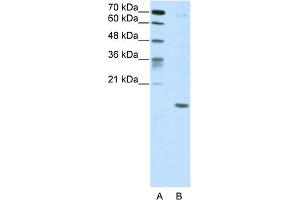 WB Suggested Anti-DUX5 Antibody Titration:  5. (DUX5 Antikörper  (C-Term))