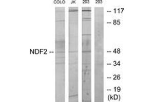 Western blot analysis of extracts from 293/COLO/Jurkat cells, using NDF2 Antibody. (NEUROD2 Antikörper  (AA 61-110))