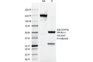 SDS-PAGE Analysis Purified Testosterone Mouse Monoclonal Antibody (4E1G2). (Testosterone Antikörper)