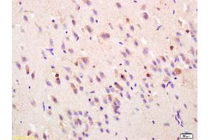 Formalin-fixed and paraffin embedded rat brain labeled with Rabbit Anti FGF1/AFGF Polyclonal Antibody, Unconjugated (ABIN726590) at 1:200 followed by conjugation to the secondary antibody and DAB staining