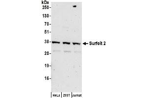 anti-Surfeit 2 (SURF2) (AA 175-225) antibody