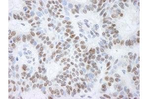 Immunohistochemistry (IHC) image for anti-Lysine (K)-Specific Demethylase 1A (KDM1A) (AA 50-100) antibody (ABIN7448433)