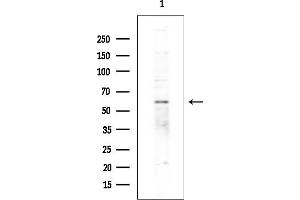 anti-Zinc Finger Protein 440 (ZNF440) antibody