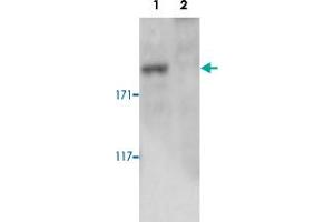 Western blot was performed on whole cell lysates from mouse fibroblasts (Lane 1, NIH/3T3) and embryonic stem cells (Lane 2, E14Tg2a) with Setd1a polyclonal antibody , diluted 1 : 500 in BSA/PBS-Tween. (SETD1A Antikörper)