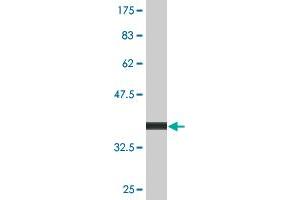 Western Blot detection against Immunogen (36. (INPP1 Antikörper  (AA 300-399))