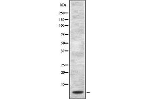 Western blot analysis of Defensin alpha1 using Jurkat whole cell lysates (alpha Defensin 1 Antikörper)