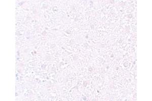 Immunohistochemistry (IHC) image for anti-Mesenchyme Homeobox 1 (MEOX1) (Middle Region) antibody (ABIN1031005) (MEOX1 Antikörper  (Middle Region))