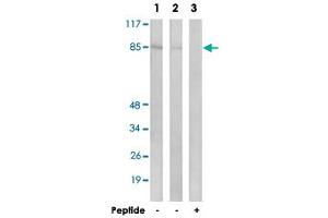 Western blot analysis of extracts from LoVo cells (Lane 1 and lane 3) and K-562 cells (Lane 2), using CHPF polyclonal antibody .