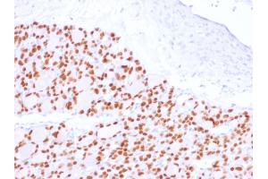 Formalin-fixed, paraffin-embedded human Thyroid stained with PAX8 Recombinant Rabbit Monoclonal Antibody (PAX8/2774R). (Rekombinanter PAX8 Antikörper  (AA 60-261))