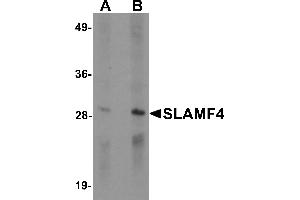 Western blot analysis of SLAMF4 in Daudi cell lysate with SLAMF4 antibody at (A) 1 and (B) 2 µg/mL. (2B4 Antikörper  (C-Term))