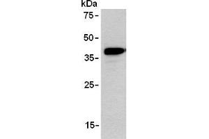 Western blot analysis of ARPP expression in TE-1 using AM26555AF-N. (ANKRD2 Antikörper)