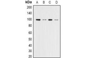 Western blot analysis of ERK3 expression in Hela (A), 293T (B), NIH3T3 (C), rat brain (D) whole cell lysates. (MAPK6 Antikörper)