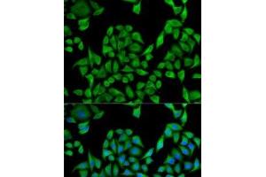 Immunofluorescence analysis of U2OS cells using UGT1A1 Polyclonal Antibody (UGT1A1 Antikörper)