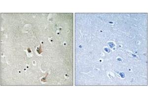 Immunohistochemistry analysis of paraffin-embedded human brain tissue, using CKS2 Antibody. (CKS2 Antikörper  (AA 1-50))