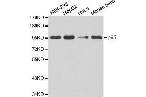 Western blot analysis of extracts of various cell lines, using NBN antibody. (Nibrin Antikörper  (AA 435-754))