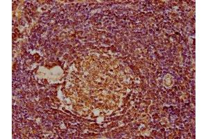IHC image of ABIN7139928 diluted at 1:300 and staining in paraffin-embedded human lymph node tissue performed on a Leica BondTM system.