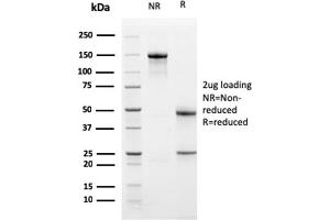 SDS-PAGE Analysis Purified TCF4 Mouse Monoclonal Antibody (PDL1/2741). (PD-L1 Antikörper  (AA 39-191))