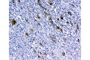 IHC analysis of 14-3-3 sigma using anti-14-3-3 sigma antibody (ABIN5693156). (14-3-3 sigma/SFN Antikörper  (AA 1-248))