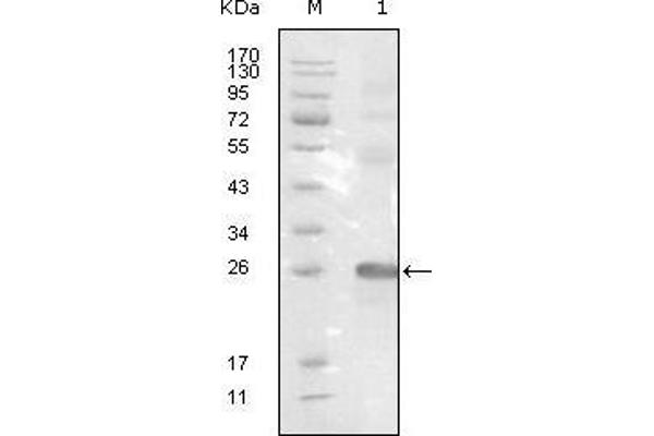 EPH Receptor B3 Antikörper  (AA 39-212)