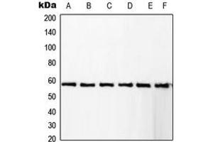 Western blot analysis of RCBTB1 expression in KNRK (A), Jurkat (B), A431 (C), HeLa (D), Raw264.