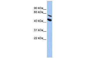 MMP24 antibody used at 1 ug/ml to detect target protein. (MMP24 Antikörper)