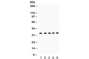 Western blot testing of 1) rat testis, 2) human 22RV1, 3) HeLa, 4) MCF7, and 5) Jurkat lysate with EBAG9 antibody. (RCAS1 Antikörper  (AA 31-213))