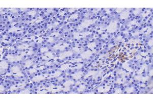 Detection of RBP4 in Human Pancreas Tissue using Polyclonal Antibody to Retinol Binding Protein 4 (RBP4) (RBP4 Antikörper)