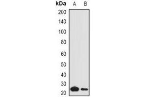 Western blot analysis of Complement C1QA expression in mouse lung (A), mouse liver (B) whole cell lysates. (C1QA Antikörper)