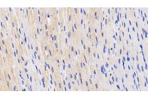 Detection of HIF2a in Human Cardiac Muscle Tissue using Polyclonal Antibody to Hypoxia Inducible Factor 2 Alpha (HIF2a)