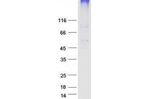 SLC19A3 Protein (Myc-DYKDDDDK Tag)