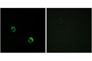 Immunofluorescence analysis of MCF7 cells, using CAR14 Antibody.