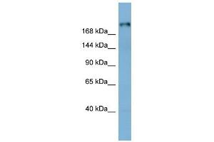 Laminin Beta 1 antibody used at 1 ug/ml to detect target protein. (Laminin beta 1 Antikörper  (Middle Region))