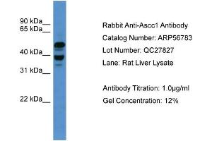 WB Suggested Anti-Ascc1  Antibody Titration: 0.