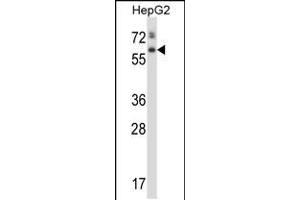 Western blot analysis in HepG2 cell line lysates (35ug/lane). (Asparaginase Antikörper  (AA 165-193))