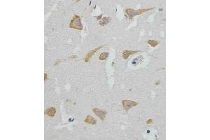 (ABIN388564 and ABIN2849716) staining GABAR in human brain tissue sections by Immunohistochemistry (IHC-P - paraformaldehyde-fixed, paraffin-embedded sections). (GABARAP Antikörper  (AA 1-30))
