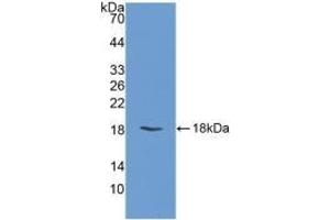 Detection of Recombinant FABP3, Bovine using Polyclonal Antibody to Heart-type Fatty Acid Binding Protein (H-FABP) (FABP3 Antikörper  (AA 1-133))