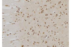 ABIN6276553 at 1/100 staining Human brain tissue by IHC-P. (DUSP6 Antikörper  (Internal Region))