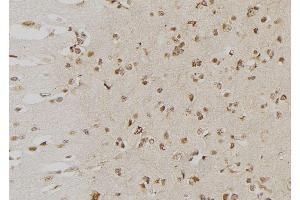 ABIN6276553 at 1/100 staining Human brain tissue by IHC-P. (DUSP6 Antikörper  (Internal Region))