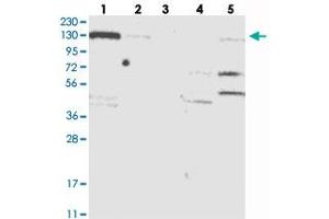Western blot analysis of Lane 1: RT-4, Lane 2: U-251 MG, Lane 3: Human Plasma, Lane 4: Liver, Lane 5: Tonsil with NCOA7 polyclonal antibody  at 1:250-1:500 dilution. (NCOA7 Antikörper)