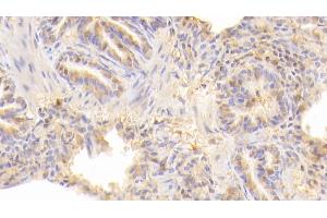 Immunohistochemistry (IHC) image for anti-CD40 Ligand (CD40LG) (AA 1-261) antibody (ABIN7442618)