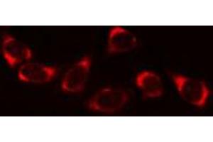 ABIN6269268 staining A549 cells by IF/ICC. (PLA2G4A Antikörper  (Internal Region))