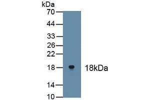 Detection of Recombinant TP63, Human using Polyclonal Antibody to Tumor Protein P63 (TP63) (p63 Antikörper)