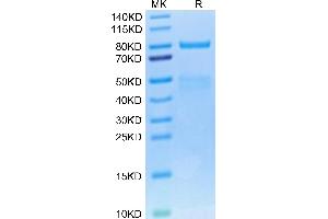 Cynomolgus HGF R on Tris-Bis PAGE under reduced condition. (c-MET Protein (AA 25-930) (His tag))